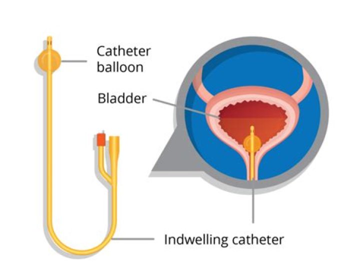 How do you clean a bladder tube?