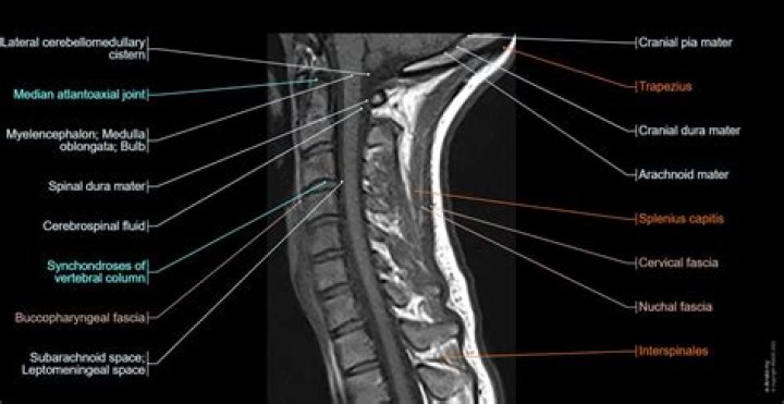 How do you describe a MRI image?