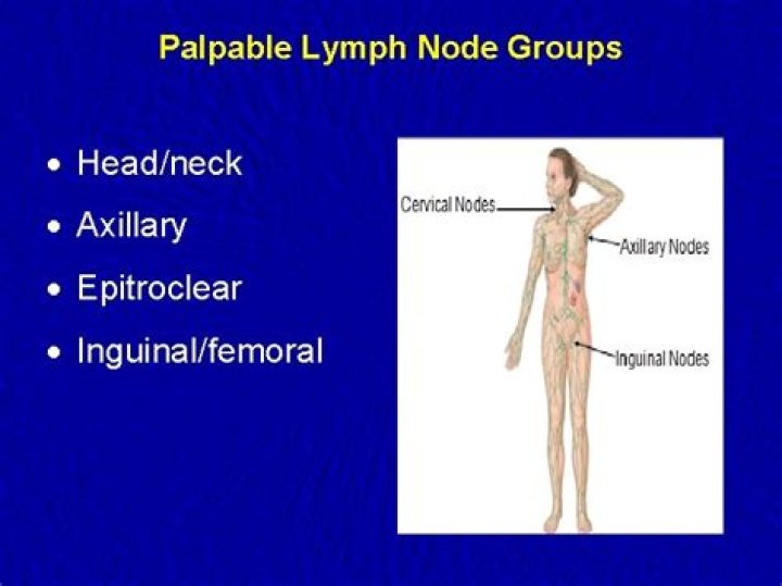 How do you describe a palpable lymph node?