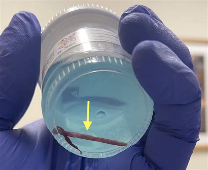 How do you get a bone marrow test kit?