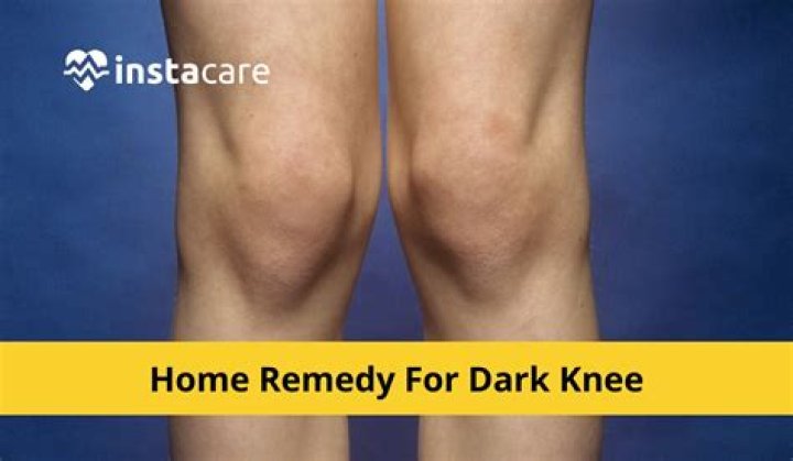 How do you get rid of dark knees fast?