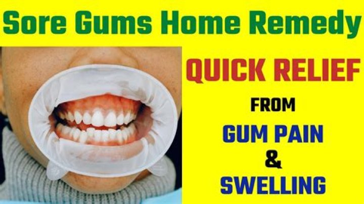 How do you get rid of sore gums from braces?