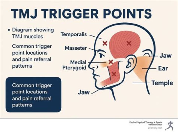 How do you get TMJ pain?