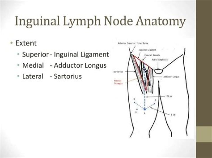 How do you heal an inguinal ligament?