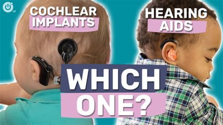 How do you keep a cochlear implant on a baby?