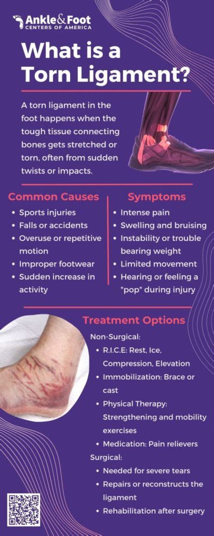 How do you loosen a tight ligament in your foot?