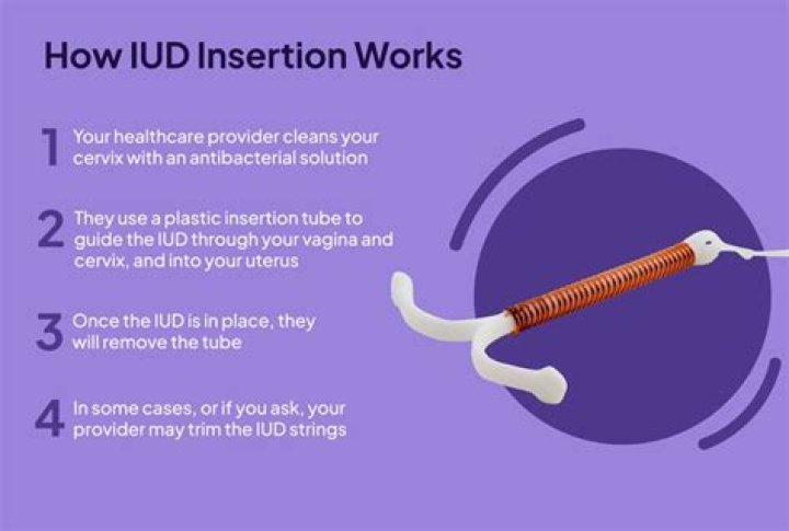 How do you manage IUFD?