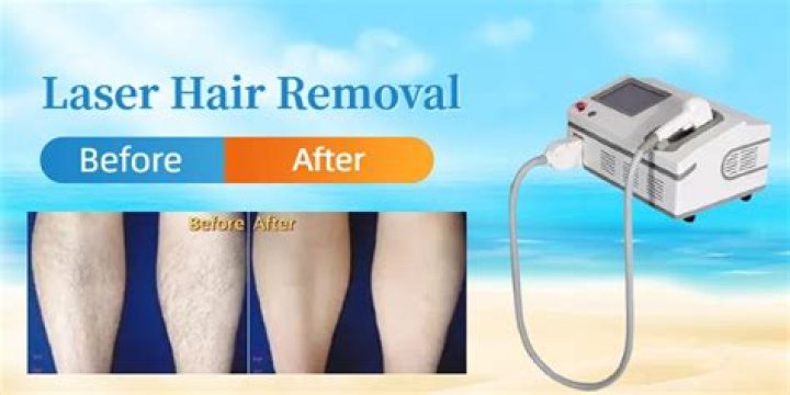 How do you numb before laser hair removal?