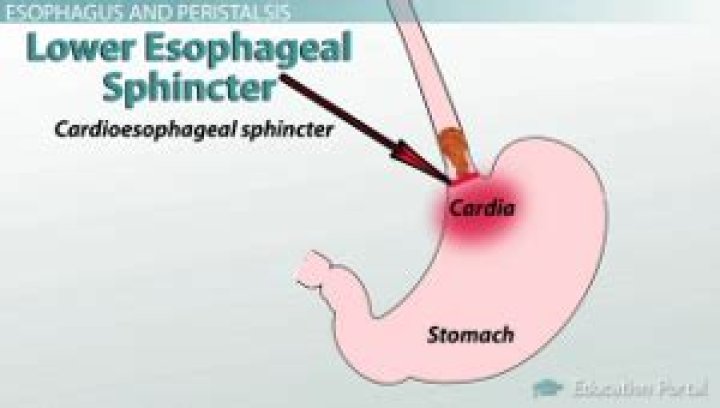 How do you strengthen your lower esophageal sphincter?