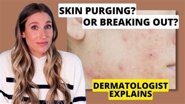 How do you take care of your body after purging?