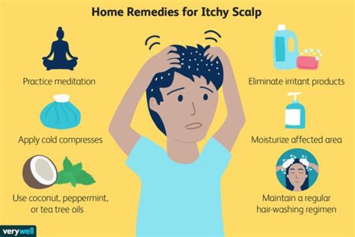How do you treat scalp inflammation naturally?