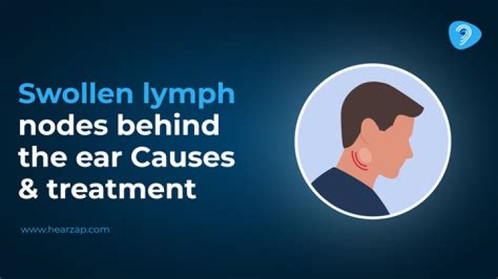 How do you treat swollen lymph nodes in front of ear?