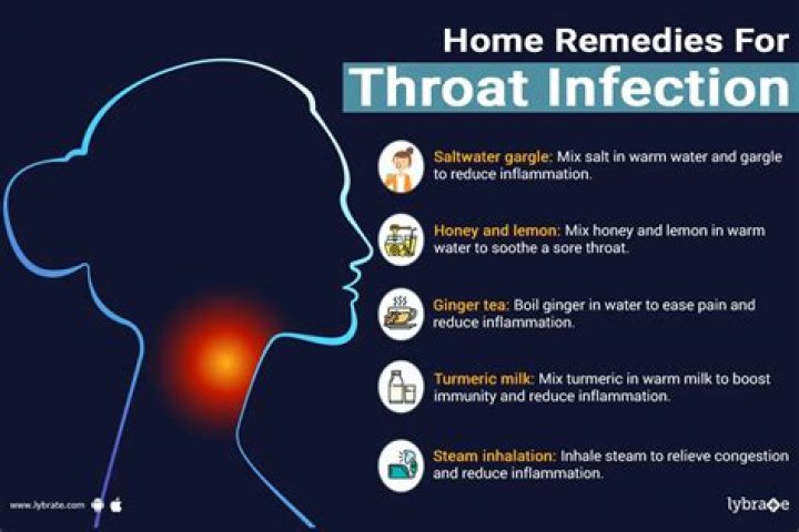 How do you treat throat bacteria?