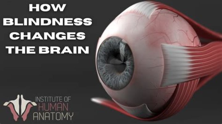 How does blindness affect the brain?