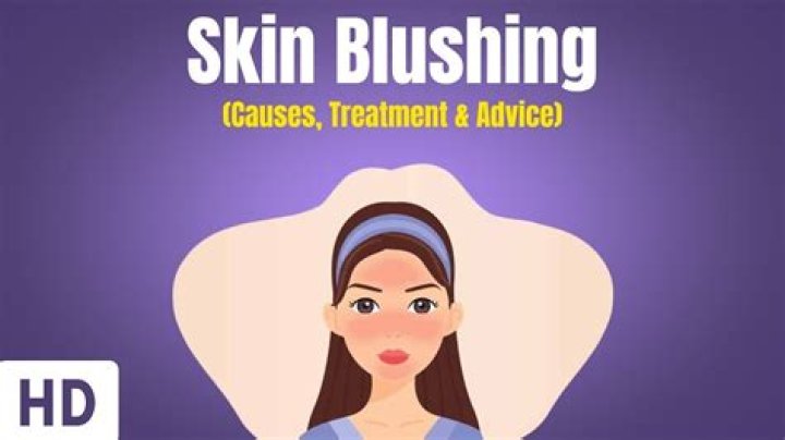 How does blushing look like?