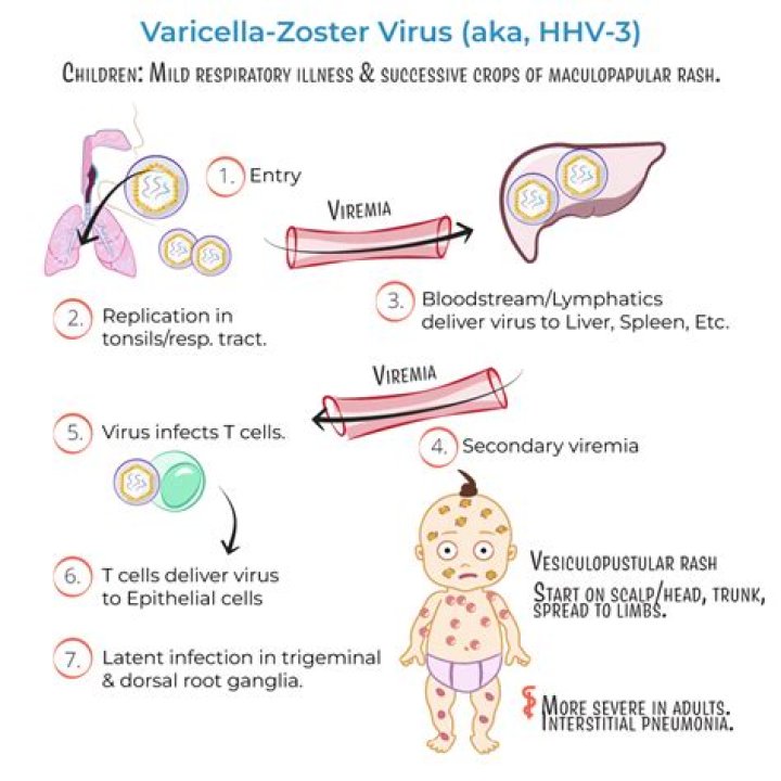 How does varicella zoster virus attack?