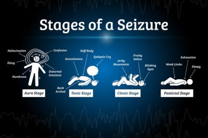 How hot do you have to be to have a seizure?