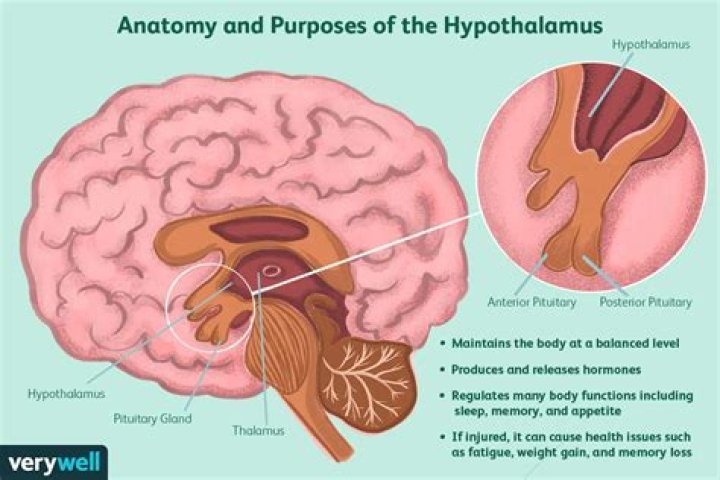 How is hypothalamic dysfunction diagnosed?