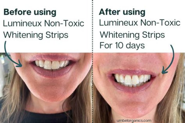 How long do your teeth stay white after whitening strips?