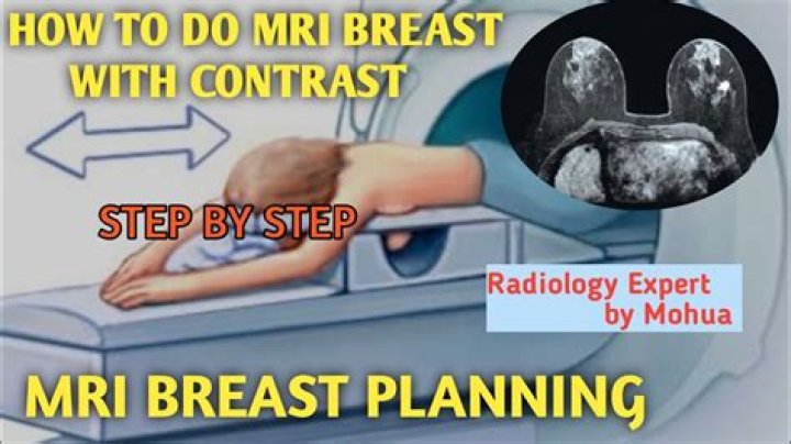 How long does a breast MRI take with contrast?