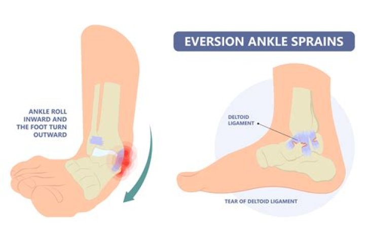 How long does a sprained fetlock take to heal?