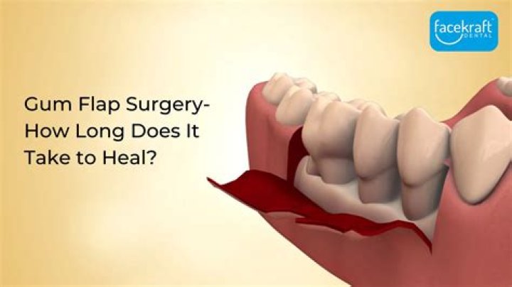 How long does it take for gum surgery to heal?