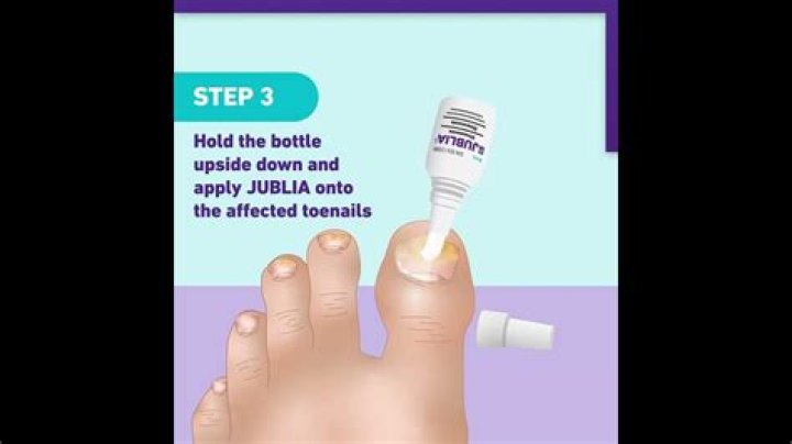 How long does it take Jublia to get rid of nail fungus?