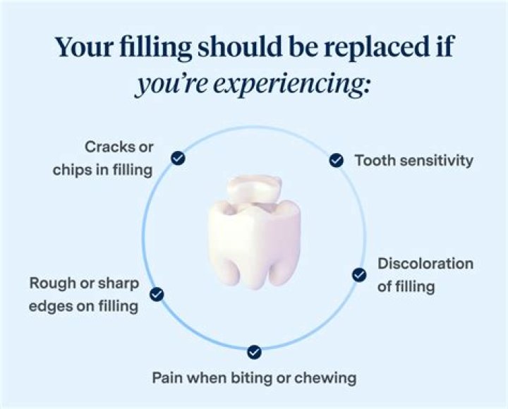 How long should a tooth filling last?