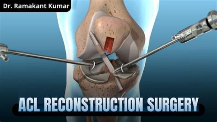 How many ACL reconstructions are there per year?