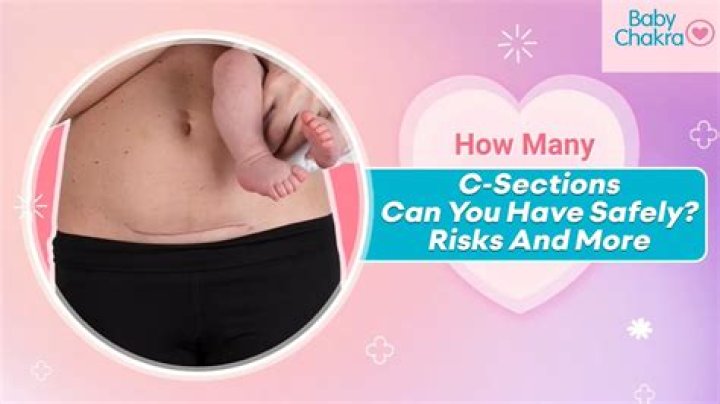How many C-sections can you have safely?