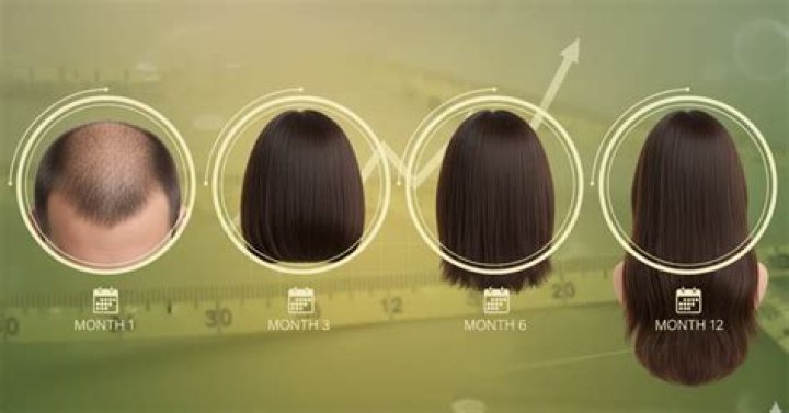 How many inches does your hair grow with a sew-in?