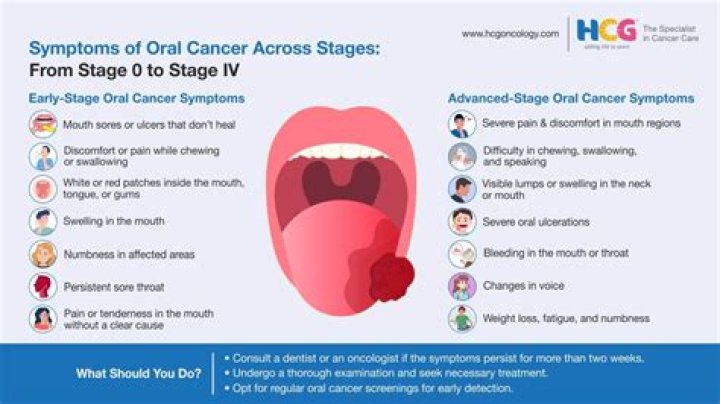 How many people per year get oral cancer?