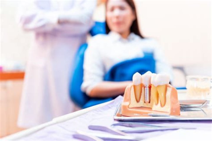 How much are dental implants in Miami?