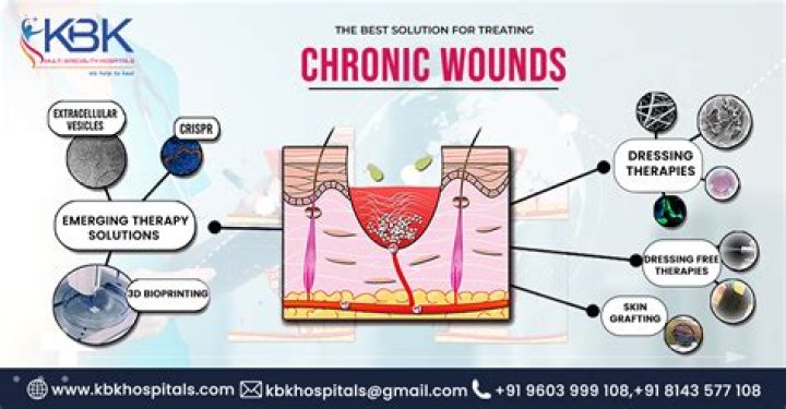 How much do chronic wounds cost the NHS?