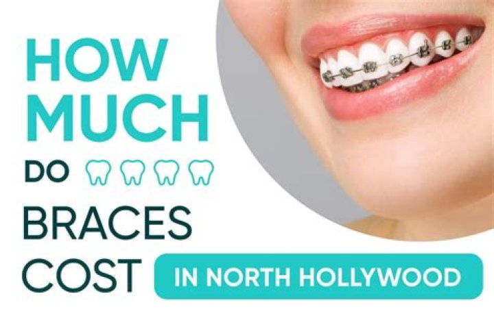 How much does braces cost for a 12 year old?