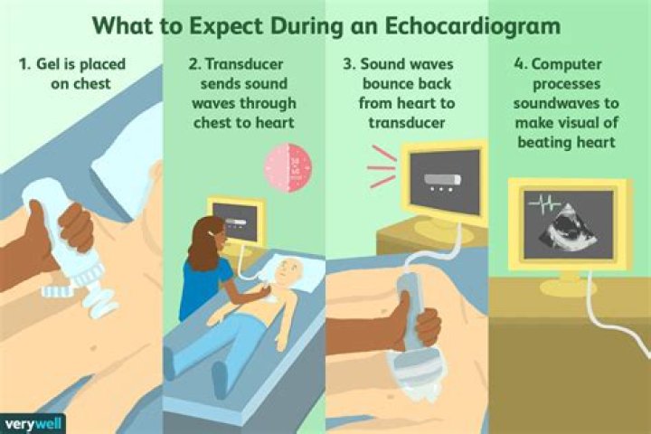 How much does echocardiogram cost with insurance?