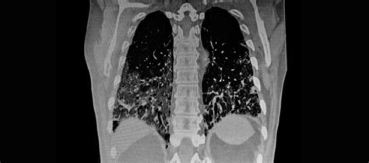 How much is a CT scan in Spain?