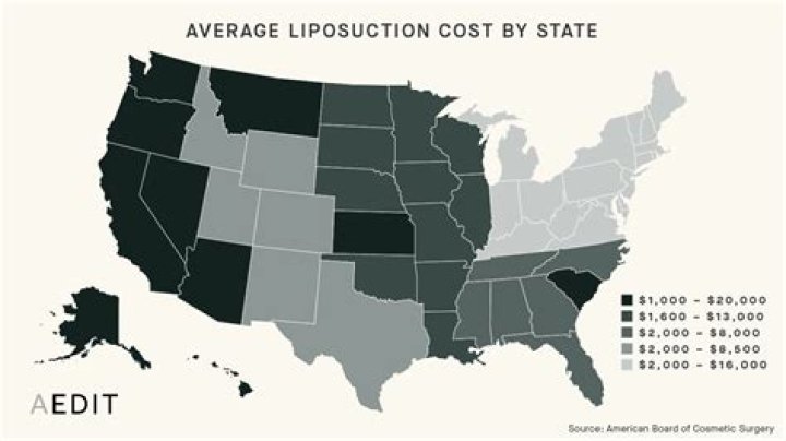 How much is liposuction in Columbia?