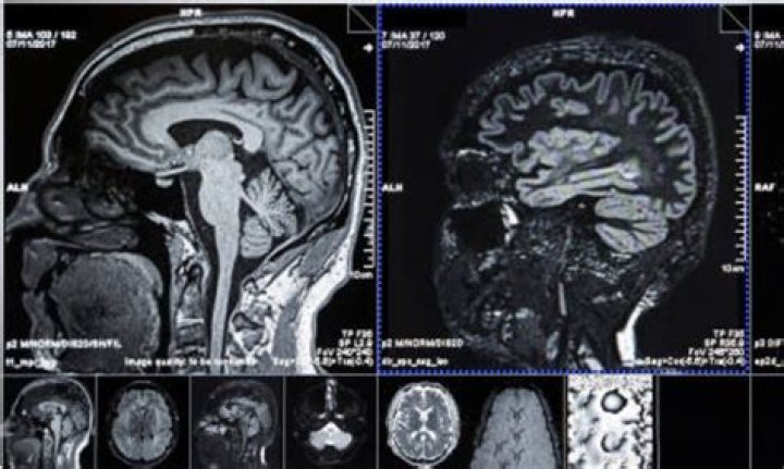 How often are CT scans wrong?