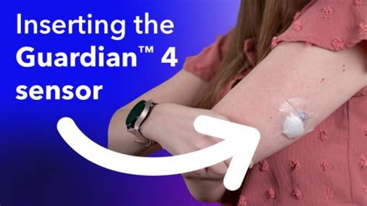 How often do you change Guardian sensor?
