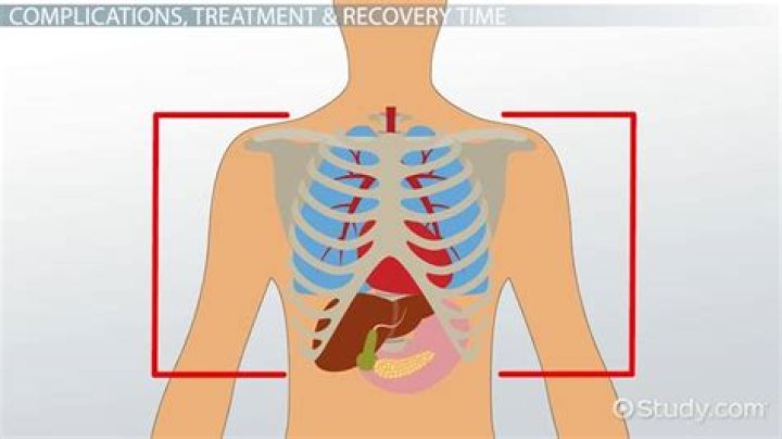 How serious is a chest contusion?