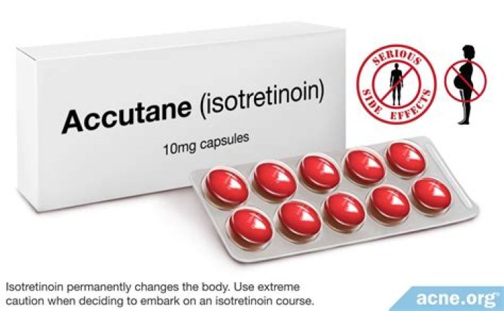 Is Accutane still prescribed for acne?