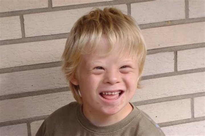 Is ADHD a syndrome?