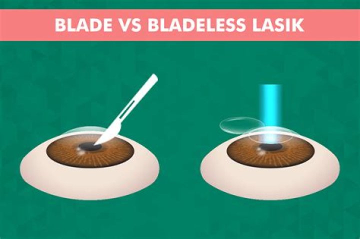 Is bladeless Lasik better?