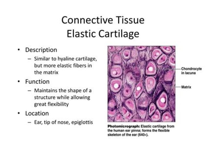 Is cartilage a connective tissue?
