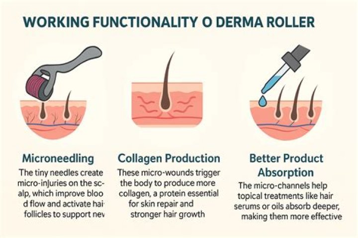 Is dermaroller really effective?