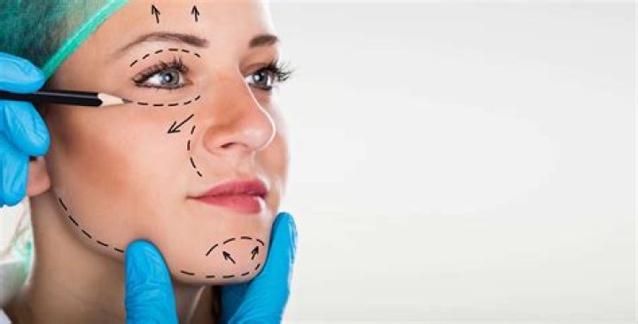Is facial feminization surgery covered by insurance?
