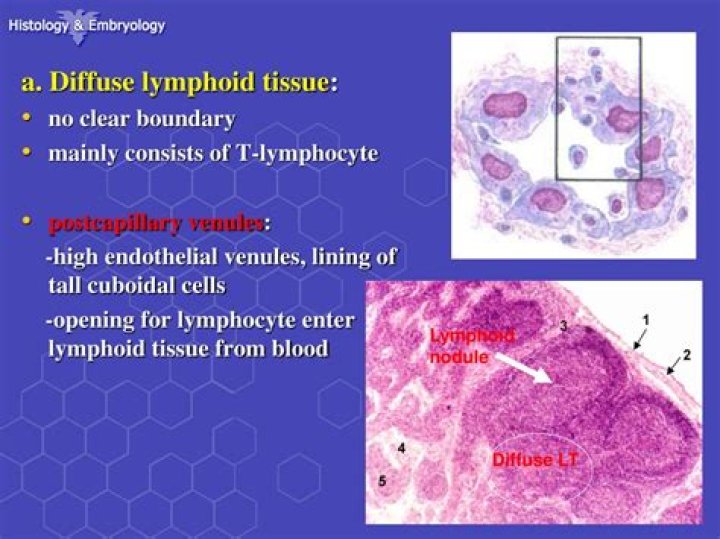 Is lymphoid tissue a connective tissue?