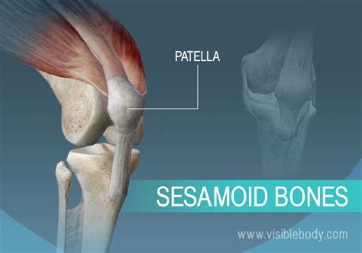 Is OS Trigonum a sesamoid bone?