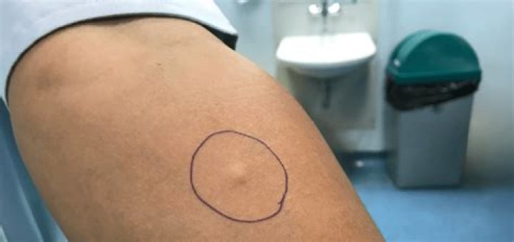 Is PPD and TB the same thing?